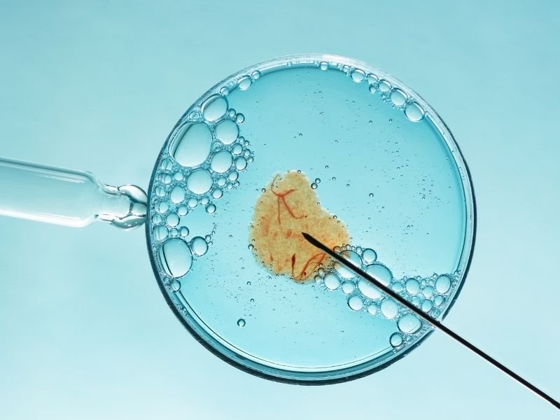 In vitro fertilization (IVF)