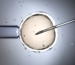 common IVF mistakes